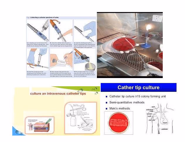 What is the Maki method in microbiology?