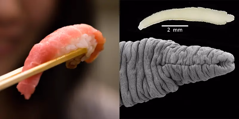 Should I do a parasite cleanse if I eat sushi?